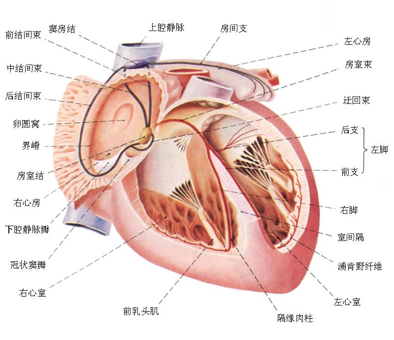 心室肌致密化不全