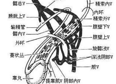 重要体征 表面皮肤红肿,精索呈纺锤形或条索状增粗,触痛明显,输精管不