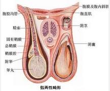 假两性畸形