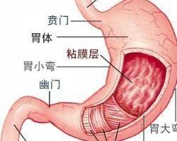 1症状编辑主要表现为胃脘部隐隐作痛,上腹部不适,脘胀微微,灼热不适