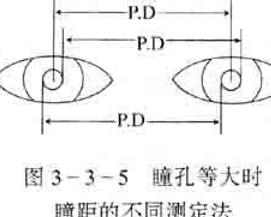 瞳孔大小不等