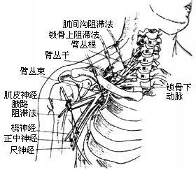 由于臂丛神经受损而引起颈,肩,上臂,前臂和手的疼痛,称为臂神经痛.