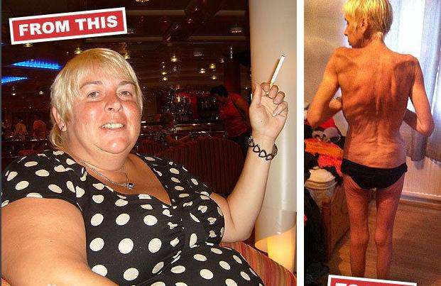 怎样才能瘦成皮包骨头 0