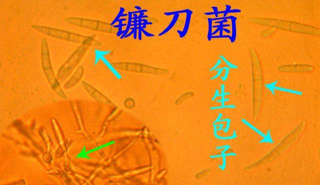 镰刀菌属