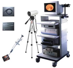 腹腔镜胆囊切除术