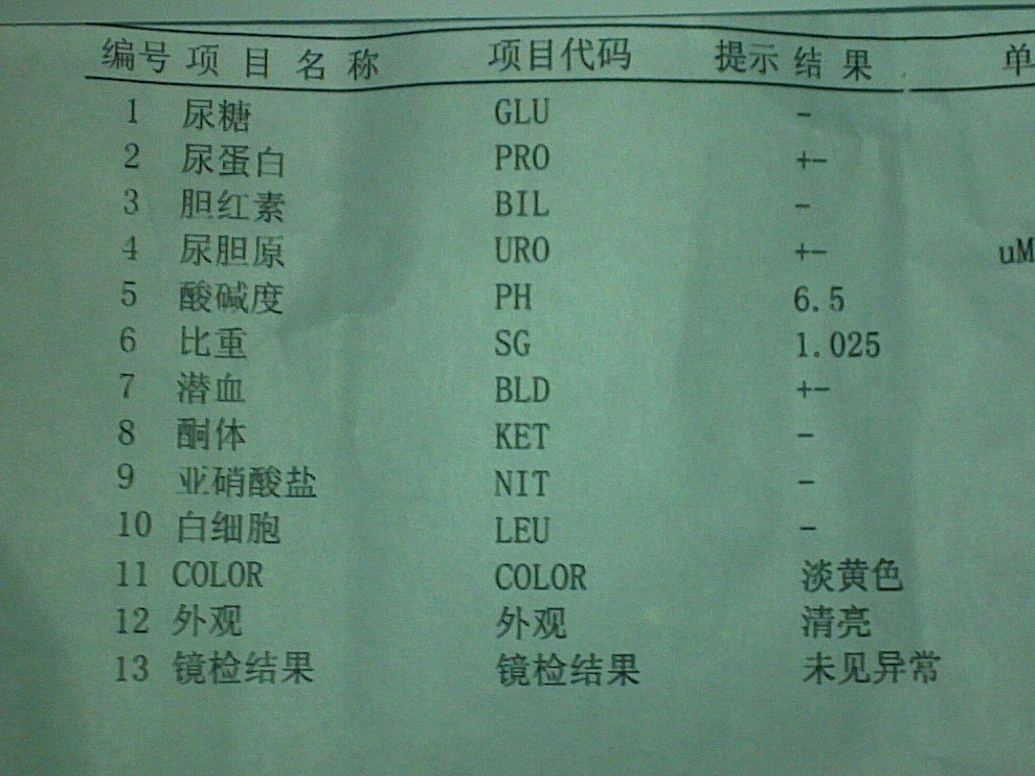 怎样看尿常规检查?白细胞3+说明健康有问题吗?