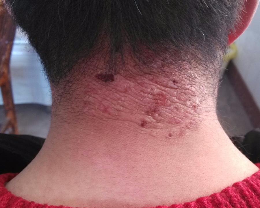 神经症常见的症状是什么？-第3张图片-粤海养生保养常识网
