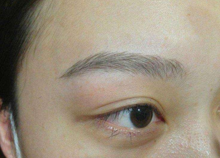 1,面部或眉区有疖,毛囊炎等感染者.局部有炎症,皮疹者.