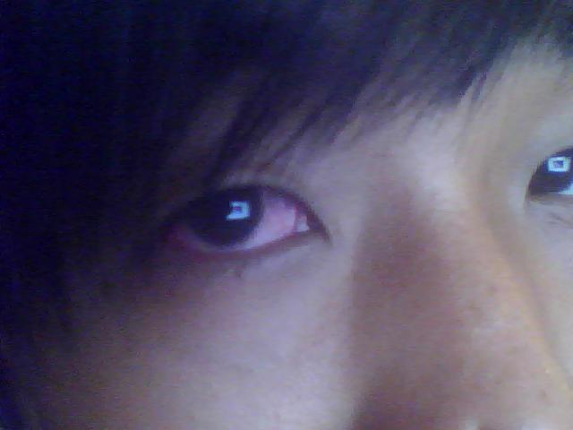 阴阳眼