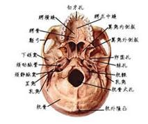 颅底骨折