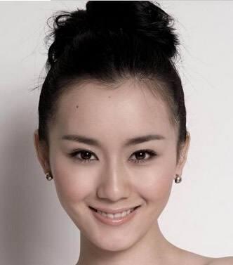 美人尖