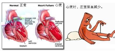 心衰老人吃什么保健品好