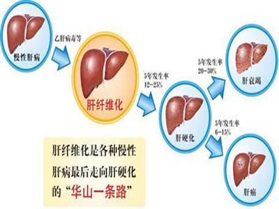 肝的位置图片