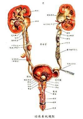 经输尿管膀胱尿道排出在这一器官中存在的结石知道我们称为泌尿系结石