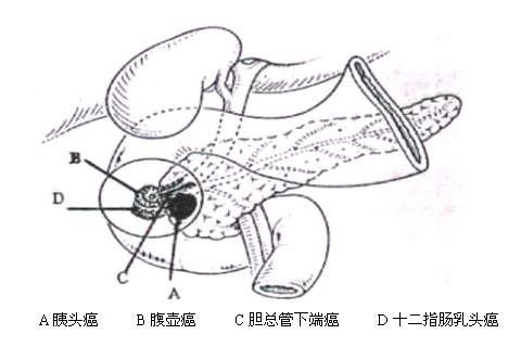 输卵管