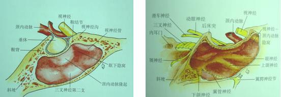 视神经管减压术