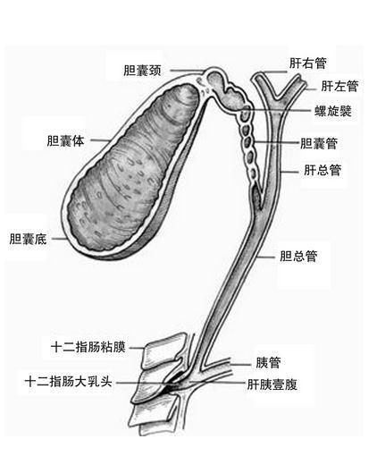 多发性胆囊息肉