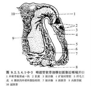 经颅内窝径路咽鼓管成形术