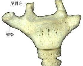 处于人体腰下部与肛门上部的尾骨,由4～5节尾椎融合而成,底部与骶椎