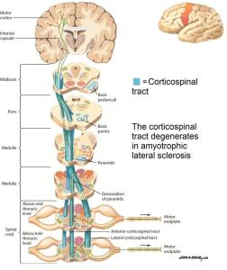 编辑词条 皮质脊髓束 (corticospinal system),是人类脊髓中最大的