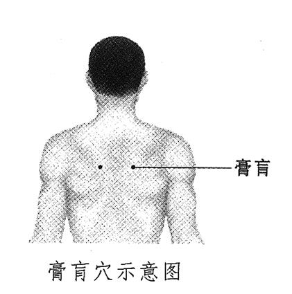 膏肓穴