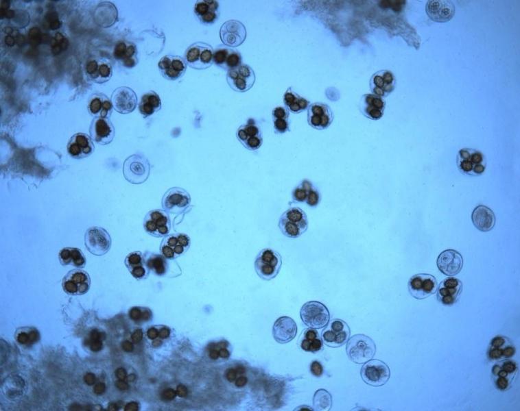 子囊孢子与孢子存在着本质差别,前者是由两种不同性别的细胞,经质配