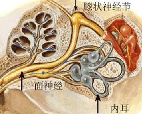 什么叫做神经炎