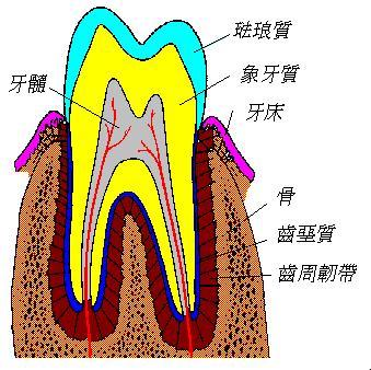 牙髓坏死