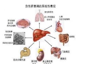 疾病症状5临床表现4发病机制3病理生理2发病原因1疾病分类录目肝衰竭