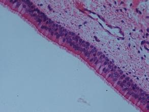 柱状细胞( columnar cell,cylindrical cell )是形成昆虫中肠上皮组织