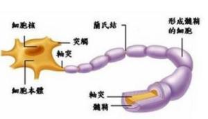 格林巴利综合症