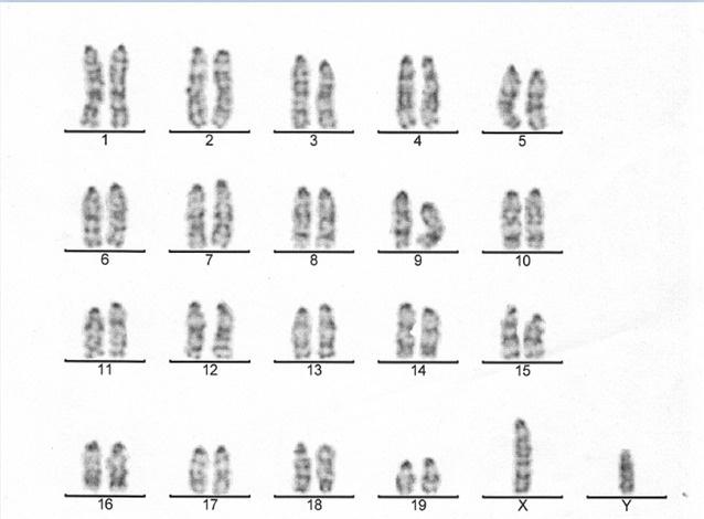 染色体核型分析