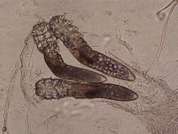 毛囊螨,又称毛囊虫,蠕形螨,寄生于多种哺乳动物,包括人的毛囊和皮脂腺