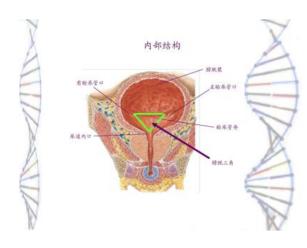膀胱三角