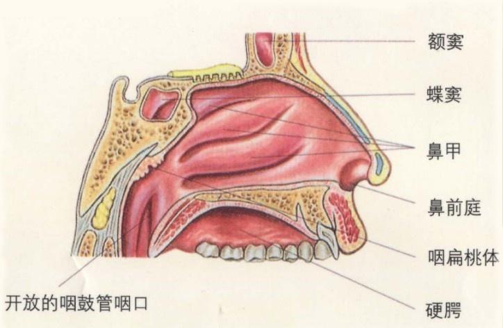 出血性鼻息肉