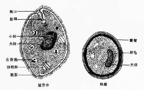 结肠阿米巴