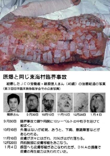 日本东海村核临界事故
