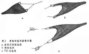 拖网捕捞 - 搜狗百科