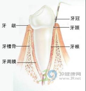 牙周膜息肉 治疗方法图片