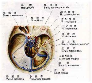 乙状窦沟图片