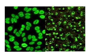 抗核抗体谱ana图片