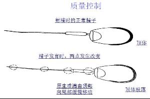 精子