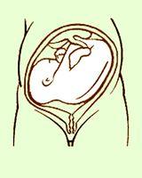 概述 胎儿横卧于子宫内,称为胎儿横位