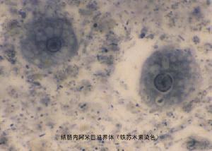 阿米巴原虫显微镜图片图片
