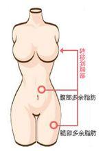 EASYSELF丰胸术示意图