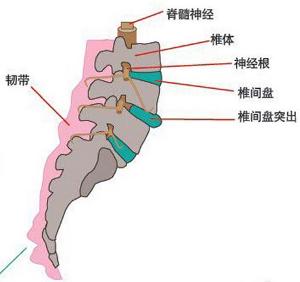 慢性腰部勞損