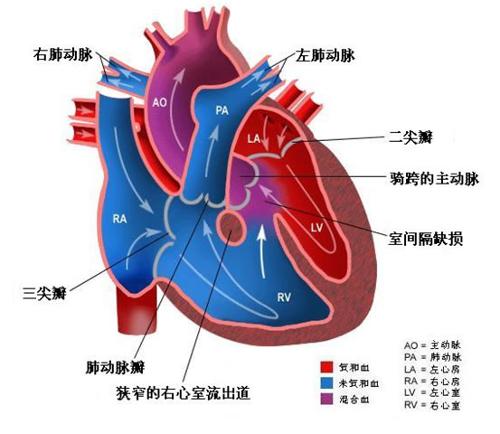 半月瓣是主动脉瓣吗图片