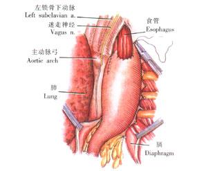食管平滑肌瘤