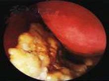 鼻石需要做哪些检查