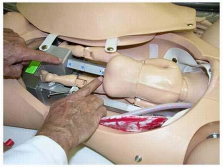 分娩意外险 有分娩险吗